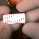 Image for article titled These 3D-Printed Devices Can Repair Damaged Airways in Kids' Lungs